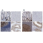Immunohistochemical staining of human colon, liver, lymph node and testis using Anti-PCNA antibody HPA030521 (A) shows similar protein distribution across tissues to independent antibody HPA030522 (B).