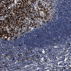 Immunohistochemical staining of human lymph node shows strong nuclear positivity in germinal center cells.