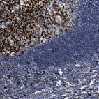 Immunohistochemical staining of human lymph node shows strong nuclear positivity in germinal center cells.
