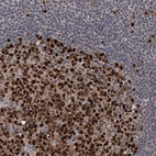 Immunohistochemical staining of human lymph node shows strong nuclear positivity in germinal center cells.