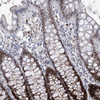 Immunohistochemical staining of human colon shows strong nuclear positivity in glandular cells.