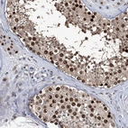 Immunohistochemical staining of human testis shows strong nuclear positivity in cells in seminiferous ducts.