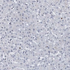Immunohistochemical staining of human liver shows no positivity in hepatocytes as expexted.