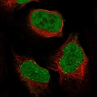 Immunofluorescent staining of human cell line U-2 OS shows localization to nuclear bodies.
