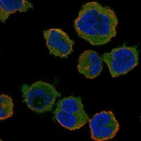 Anti-TNFSF13B Antibody