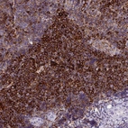 Immunohistochemical staining of human tonsil shows strong cytoplasmic and membranous positivity in non-germinal center cells.