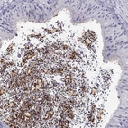 Immunohistochemical staining of human epididymis shows strong cytoplasmic and membranous positivity in glandular cells.