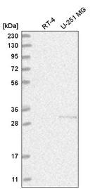 Anti-CHTOP Antibody