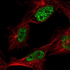 Immunofluorescent staining of human cell line U-251 MG shows localization to nuclear speckles.