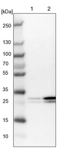 Lane 1: NIH-3T3 cell lysate (Mouse embryonic fibroblast cells)_br/_Lane 2: NBT-II cell lysate (Rat Wistar bladder tumour cells)