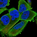 Immunofluorescent staining of human cell line RH-30 shows localization to plasma membrane & actin filaments.
