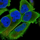 Immunofluorescent staining of human cell line RH-30 shows localization to plasma membrane & actin filaments.
