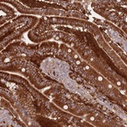 Immunohistochemical staining of human duodenum shows high expression.