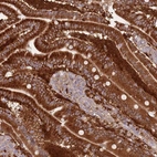 Immunohistochemical staining of human duodenum shows high expression.