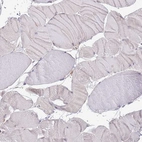 Immunohistochemical staining of human skeletal muscle shows low expression as expected.
