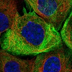 Immunofluorescent staining of human cell line A-431 shows localization to plasma membrane, cytosol & actin filaments.