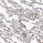 Immunohistochemical staining of human lung shows moderate membranous/cytoplasmic positivity in macrophages.