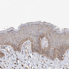 Immunohistochemical staining of human skin shows moderate membranous/cytoplasmic positivity in squamous epithelial cells.