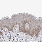 Immunohistochemical staining of human skin shows moderate membranous/cytoplasmic positivity in squamous epithelial cells.