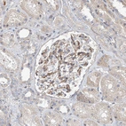 Immunohistochemical staining of human kidney shows moderate membranous/cytoplasmic positivity in cells in glomeruli.