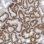 Anti-IBA57 Antibody