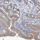 Immunohistochemical staining of human duodenum shows weak to moderate cytoplasmic positivity in glandular cells.