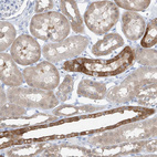 Immunohistochemical staining of human kidney shows strong cytoplasmic positivity in cells in distal tubules.