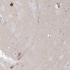 Immunohistochemical staining of human cerebral cortex shows moderate positivity in neuronal processes in neuropil and a subset of neuronal cells.