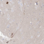 Immunohistochemical staining of human cerebral cortex shows moderate positivity in neuronal processes in neuropil and a subset of neuronal cells.