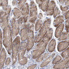 Immunohistochemical staining of human stomach shows weak to moderate cytoplasmic positivity in glandular cells.