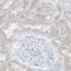Immunohistochemical staining of human kidney shows very weak cytoplasmic positivity in cells in tubules.