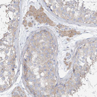 Immunohistochemical staining of human testis shows weak to moderate cytoplasmic positivity in Leydig cells.