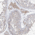 Immunohistochemical staining of human testis shows weak to moderate cytoplasmic positivity in Leydig cells.