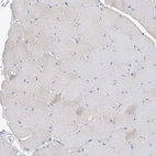 Immunohistochemical staining of human skeletal muscle shows no positivity in myocytes as expected.