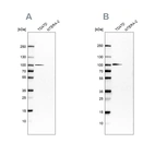 Western blot analysis using Anti-UFL1 antibody HPA030559 (A) shows similar pattern to independent antibody HPA030560 (B).