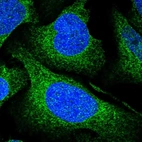Immunofluorescent staining of human cell line U-2 OS shows localization to endoplasmic reticulum.