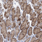 Immunohistochemical staining of human stomach shows weak to moderate cytoplasmic positivity in glandular cells.
