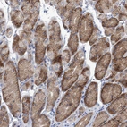 Immunohistochemical staining of human stomach shows weak to moderate cytoplasmic positivity in glandular cells.