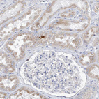 Immunohistochemical staining of human kidney shows very weak cytoplasmic positivity in cells in tubules.