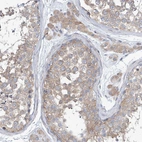 Immunohistochemical staining of human testis shows weak to moderate cytoplasmic positivity in Leydig cells and cells in seminifereus ducts.