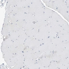 Immunohistochemical staining of human skeletal muscle shows no positivity in myocytes as expected.
