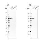 Western blot analysis using Anti-UFL1 antibody HPA030560 (A) shows similar pattern to independent antibody HPA030559 (B).