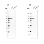 Western blot analysis using Anti-UFL1 antibody HPA030560 (A) shows similar pattern to independent antibody HPA030559 (B).