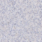 Immunohistochemical staining of human pancreas shows low expression as expected.
