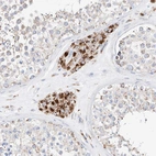 Immunohistochemical staining of human testis shows high expression.