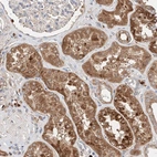 Anti-C6orf62 Antibody