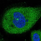 Immunofluorescent staining of human cell line A-431 shows positivity in cytoplasm.