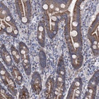 Anti-SRBD1 Antibody
