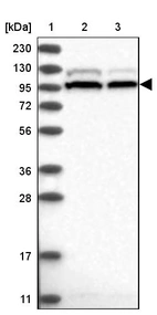 Lane 1: Marker [kDa] 230, 130, 95, 72, 56, 36, 28, 17, 11_br/_Lane 2: Human cell line RT-4_br/_Lane 3: Human cell line U-251MG sp