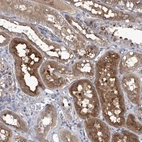 Anti-SRBD1 Antibody